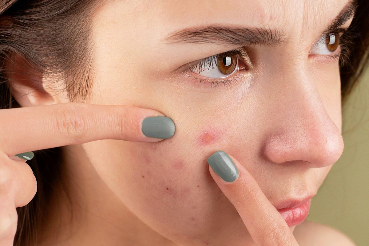 Discover Our Best Blemish Skincare Products For Acne-Prone Skin