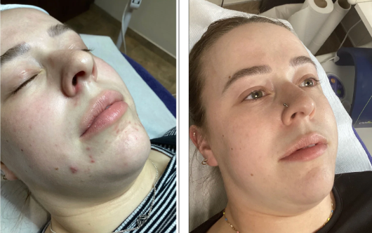 Our Clientās Skin Story: See The Transformation