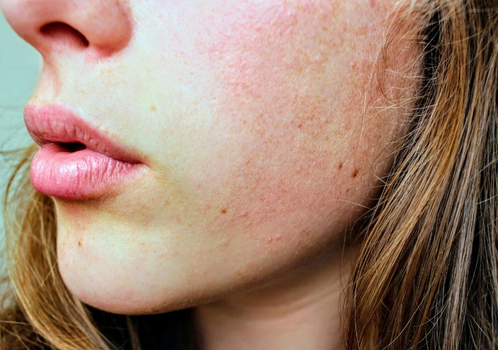 Discover The Winter Skincare Saviours That Keep Your Skin Healthy & Radiant