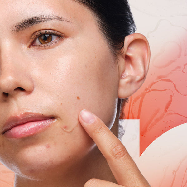 Products For Oily, Acne-Prone Skin