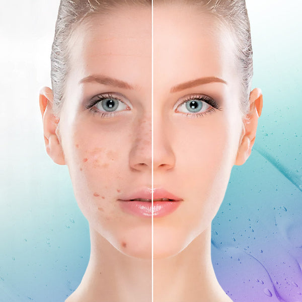 Products for Hyperpigmentation