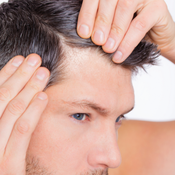 Pharmaceris P - Ichtilix-Forte Keratolytic Scalp Liquid for Psoriasis