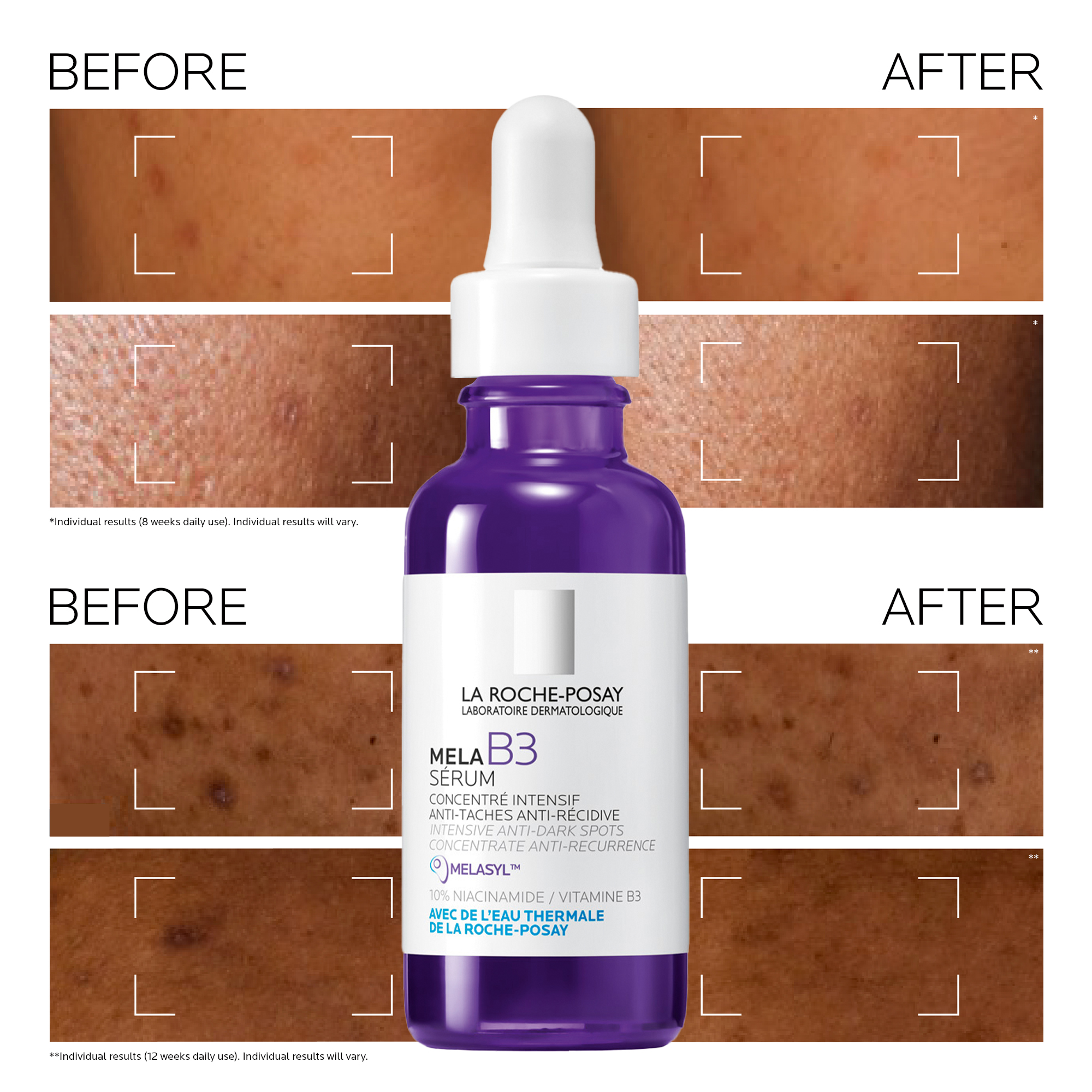 LA ROCHE-POSAY MELA B3 SERUM 50ml×2本 La Roche-Posay Mela B3 Serum Intense Anti-Dark Spot Serum For