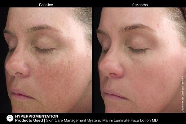 Jan Marini Luminate Face Lotion | Face the Future