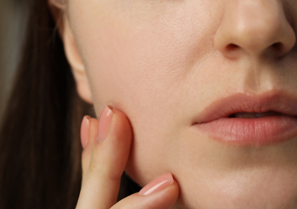 Why Your Skin Still Gets Dehydrated - Even If You Drink Water
