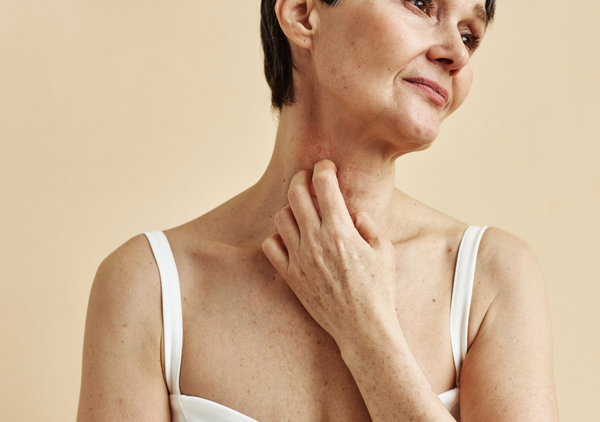 Woman itching psoriasis