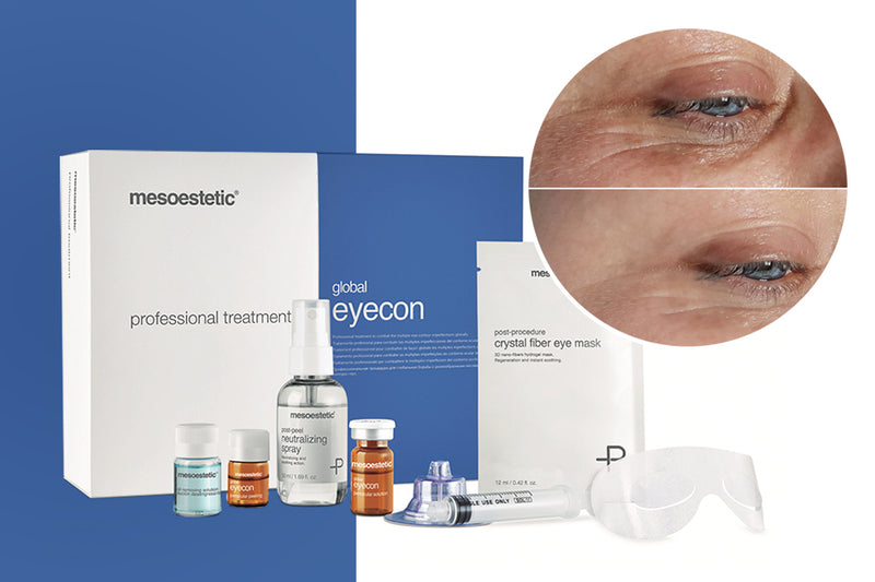 Combat Ageing In The Eye Area With Mesoestetic Global Eyecon Treatment