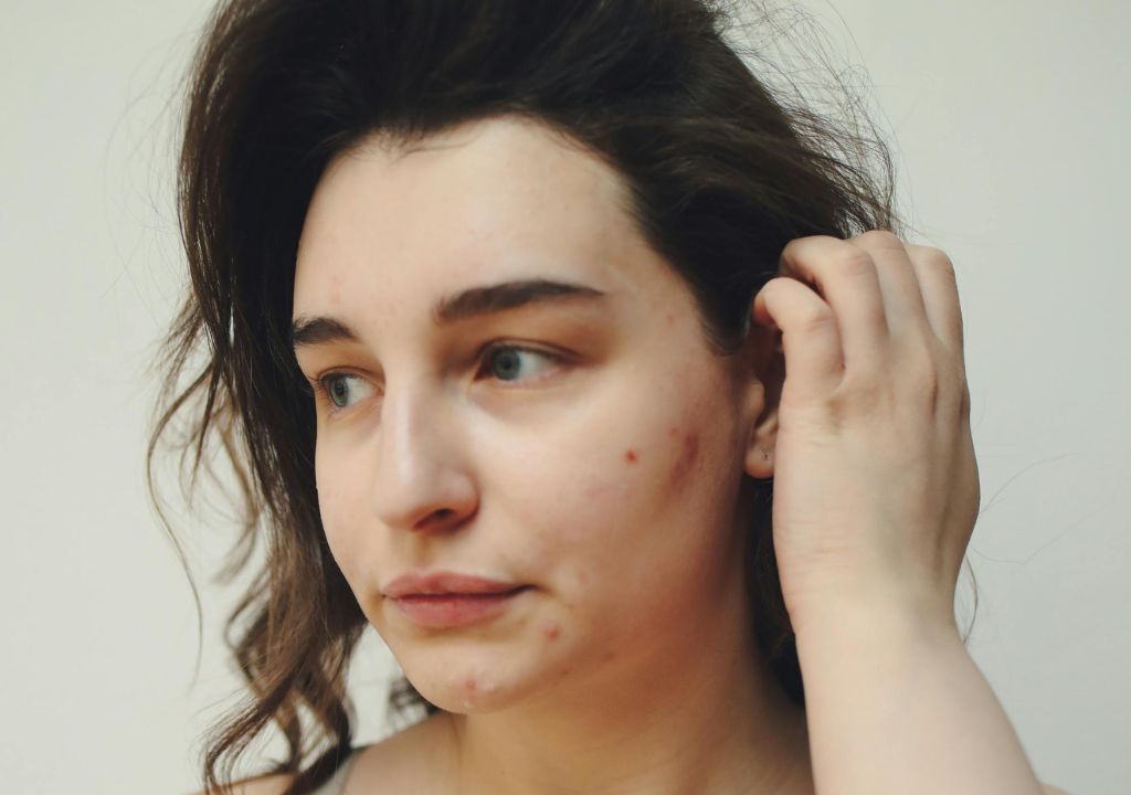 5 Stressed Skin Solutions To Soothe And Restore Your Complexion
