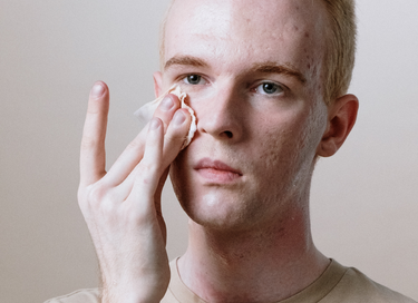 Different Types Of Acne Scars And How To Treat Them