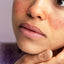Products for Rosacea