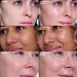 Peter Thomas Roth Collagen Skinjection™ Plumping & Firming Serum 30ml