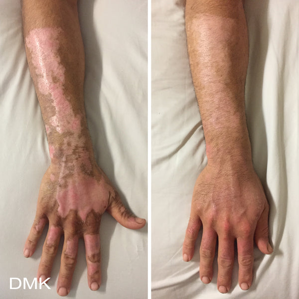 DMK Beta Gel Hydrating Beta-Glucan Serum