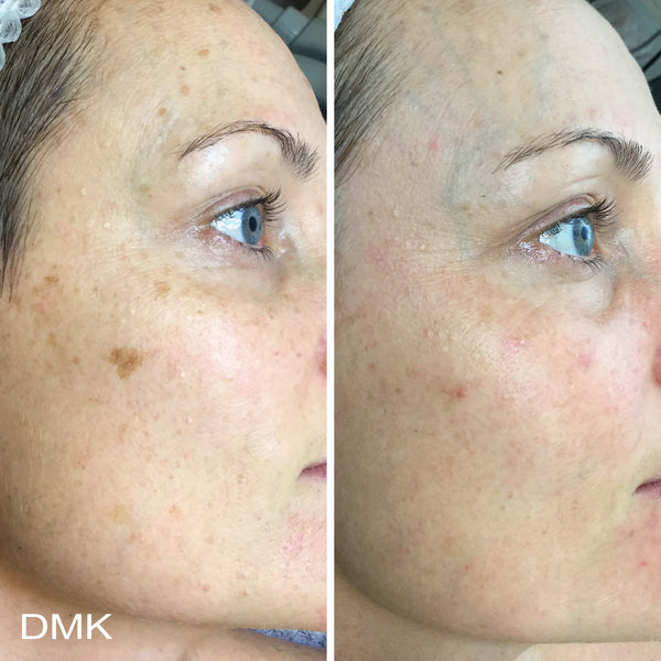 DMK Super Serum