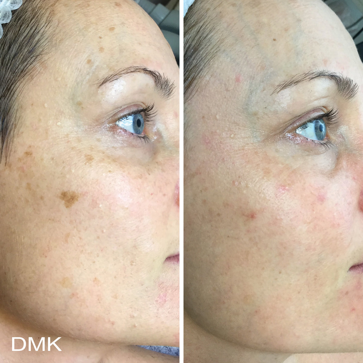 DMK Super Bright 50ml