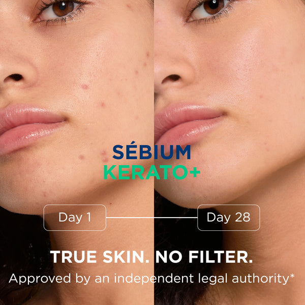 Bioderma Sébium Kerato+ Anti-Blemish Gel Cream for Acne Prone Skin