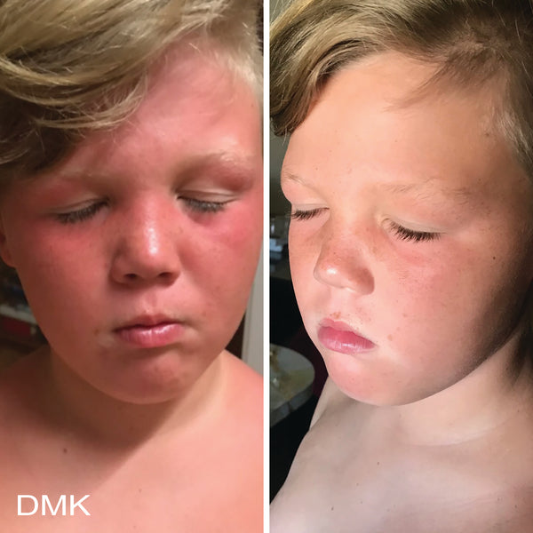 DMK Beta Gel Hydrating Beta-Glucan Serum