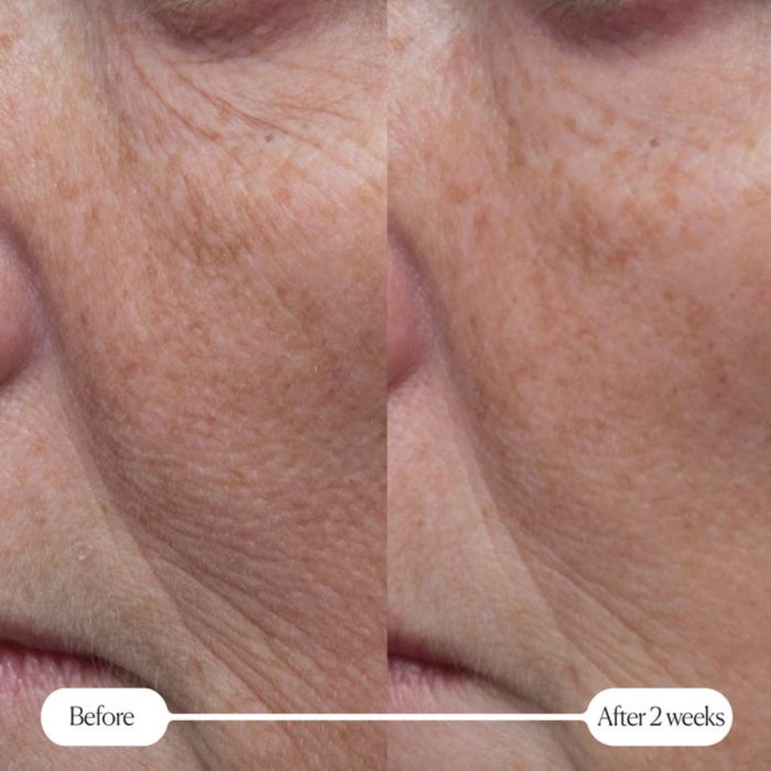Elemis Pro-Collagen Rose Marine Cream 50ml before and after