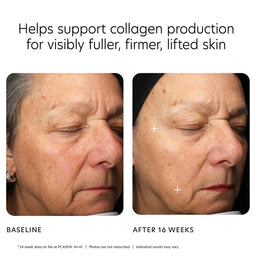 PCA MGF Age Renewal Cream