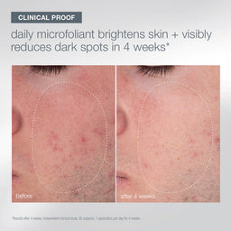 Dermalogica Expert Cleanse + Glow