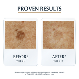 Eucerin Hyaluron-Filler + Elasticity 3D Serum