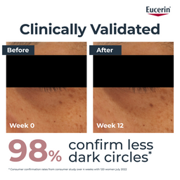 Eucerin Anti-Pigment Dark Circle Eye Corrector 15ml