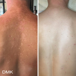 DMK Melanotech Drops