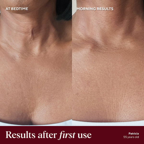 Before and after comparison of skin texture on a person's neck, labeled 'At Bedtime' and 'Morning Results'.