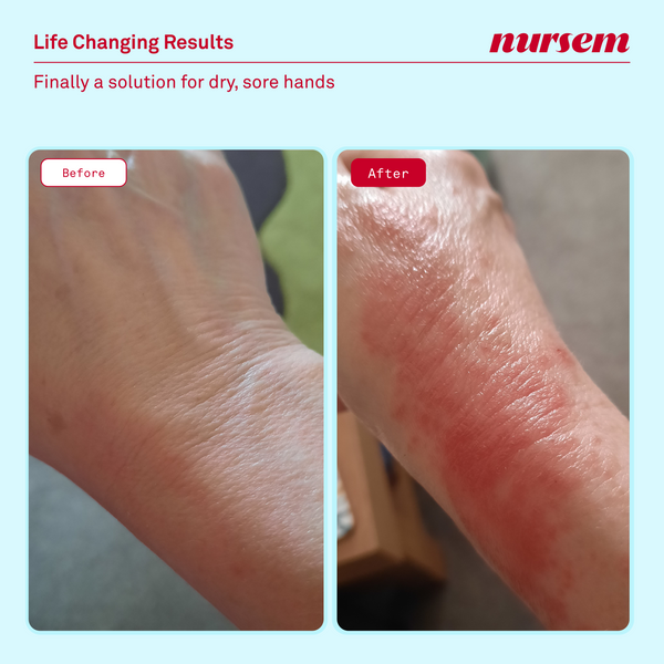 Nursem Caring Skin Fix 50ml