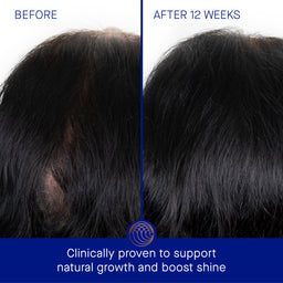 Augustinus Bader The Scalp Treatment