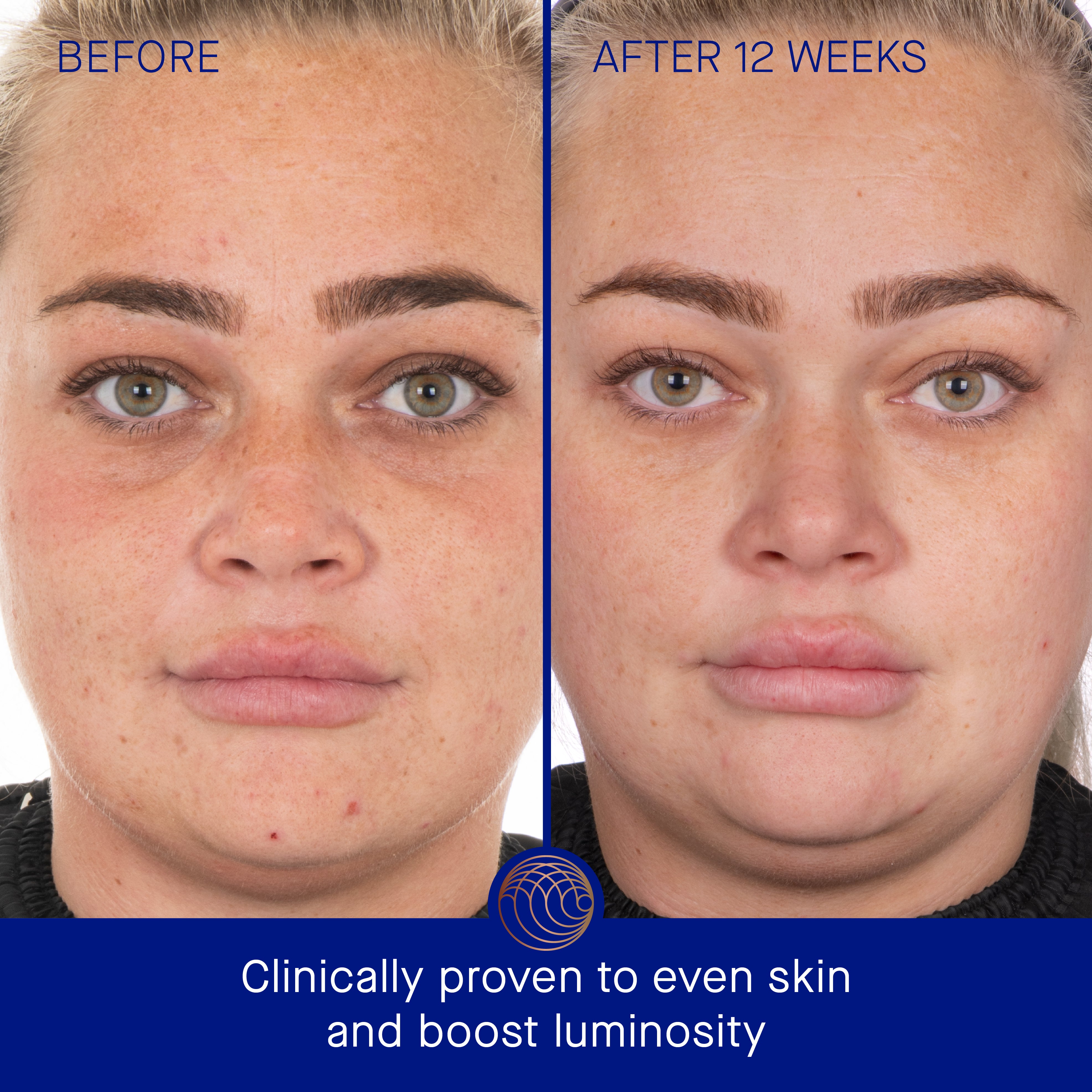 Augustinus Bader The Face Cream Mask | Face the Future