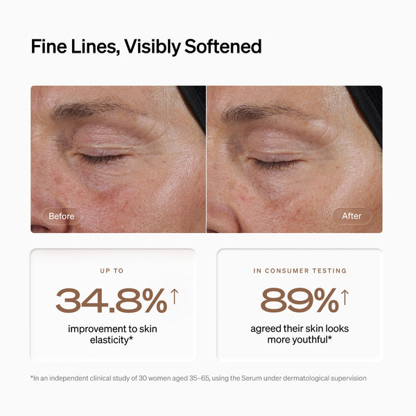 Before-and-after skincare comparison showing a woman's eye area with fine lines and wrinkles, with text stating 'Fine Lines, Visibly Softened' and results of up to 34.8% improvement in skin elasticity and 89% agreement that skin looks more youthful.