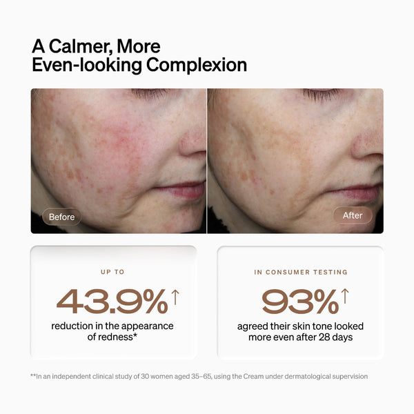 Before-and-after skin comparison graphic showing a woman's cheek with redness, alongside text claiming a 43.9% reduction in redness and 93% agreement in consumer testing.