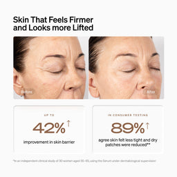 Promotional graphic for a skincare product showing before-and-after close-up photos of a woman's face, with text stating 'Skin That Feels Firmer and Looks more Lifted' and results including 'up to 42% improvement in skin barrier' and '89% agree skin felt less tight and dry patches were reduced'.