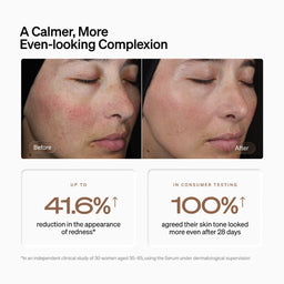 Before-and-after skin comparison showing a woman's face with redness reduced over time, accompanied by text claims about even-looking complexion and skin tone improvement.