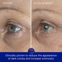 Augustinus Bader The Eye Cream Nomad