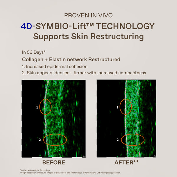 An informational marketing graphic for 4D-Symbio-Lift Technology, showing before-and-after ultrasound images of skin collagen and elastin network restructuring over a 56-day period.