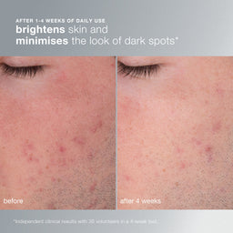 Dermalogica Daily Microfoliant®