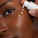 Hyperpigmentation