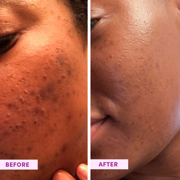 Sand & Sky Australian Glow Berries Enzyme Powder Exfoliator