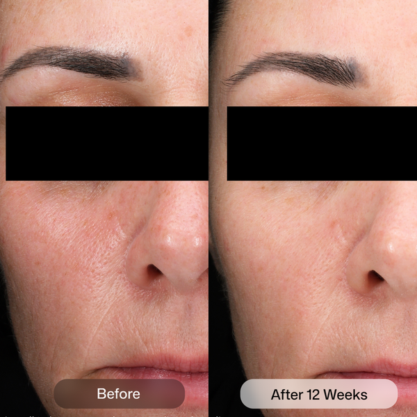 Revision Skincare D·E·J Daily Boosting Serum 30ml