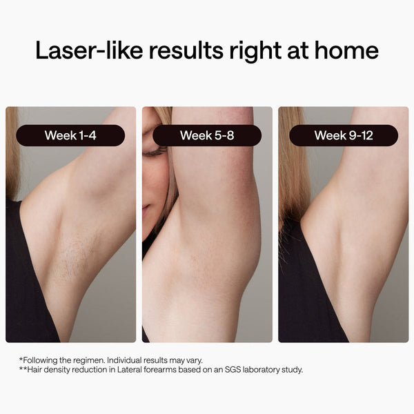 A before-and-after style comparison graphic showing three close-up views of a person's underarm labeled Week 1-4, Week 5-8, and Week 9-12, with the headline 'Laser-like results right at home' and small disclaimer text below.