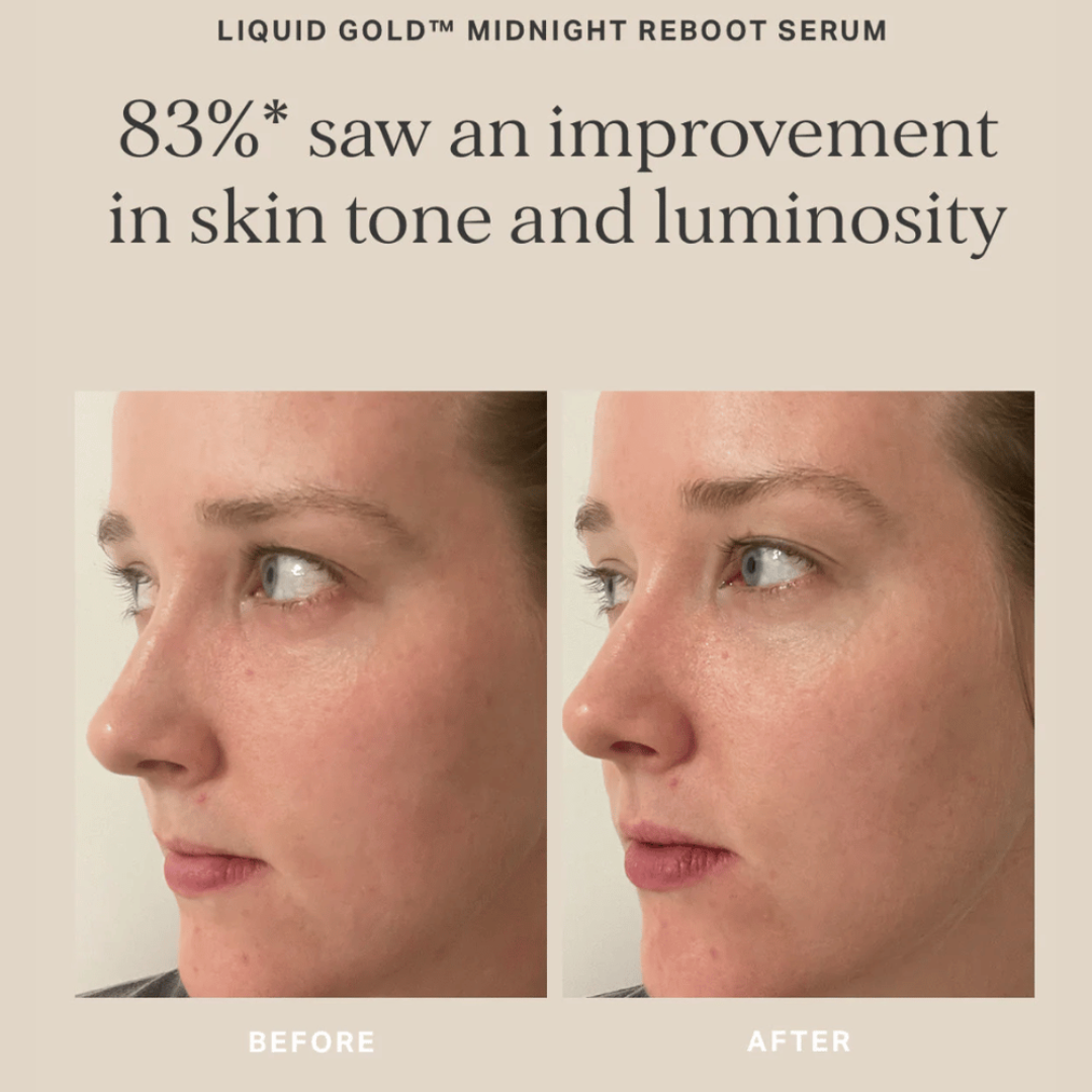 Alpha-H Midnight Reboot Serum 50ml