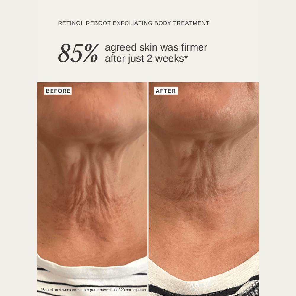Alpha-H Retinol Reboot Exfoliating Body Treatment 120ml