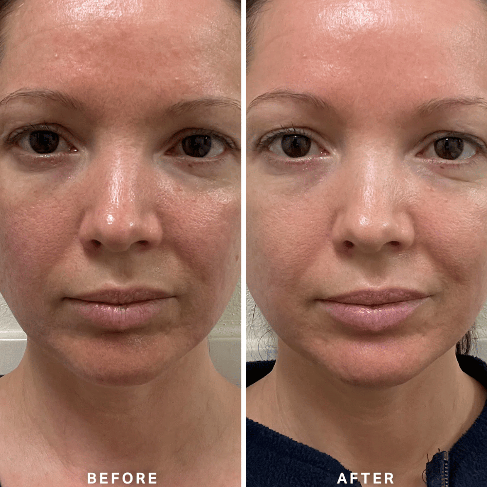 Alpha-H Vitamin B Serum 10ml