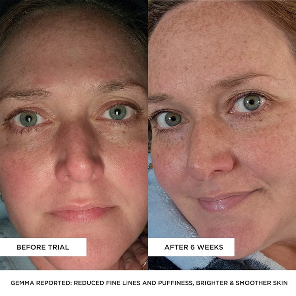 BEAUTYPRO LED Wand 5 In 1 Anti-Ageing Device