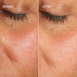 Gatineau Renewal Ultime™ Multi-Acid Resurfacing Pads 14