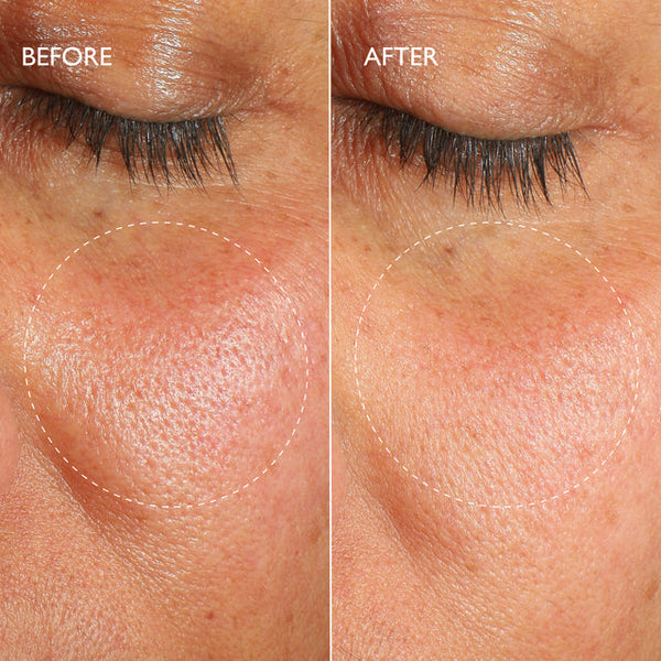 Gatineau Renewal Ultime™ Multi-Acid Resurfacing Pads 14