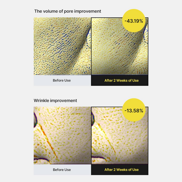 Before and after comparison of pore and wrinkle improvement with numerical percentages shown.