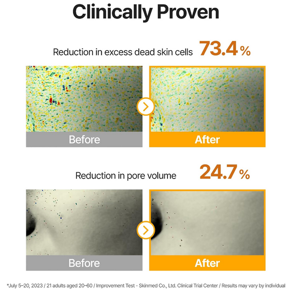 Clinical results graphic showing a reduction in excess dead skin cells by 73.4% and a reduction in pore volume by 24.