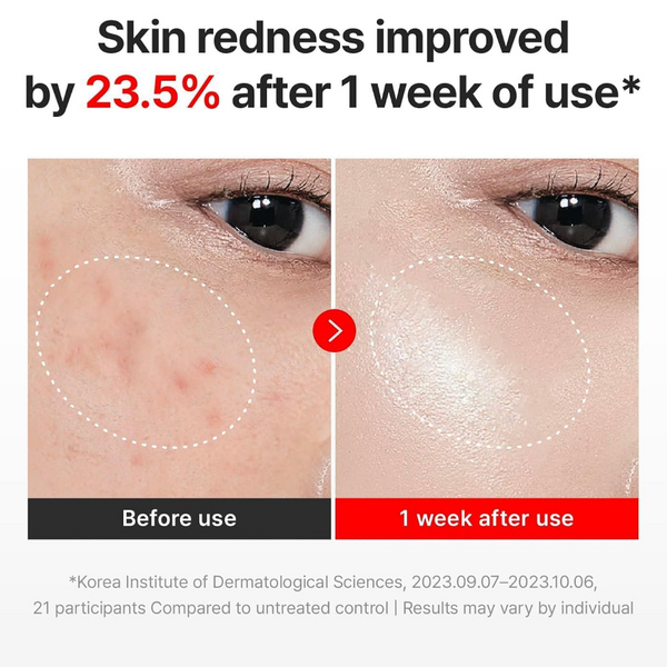 Before and after comparison of skin redness improvement with text indicating 23.5% reduction after one week of use.